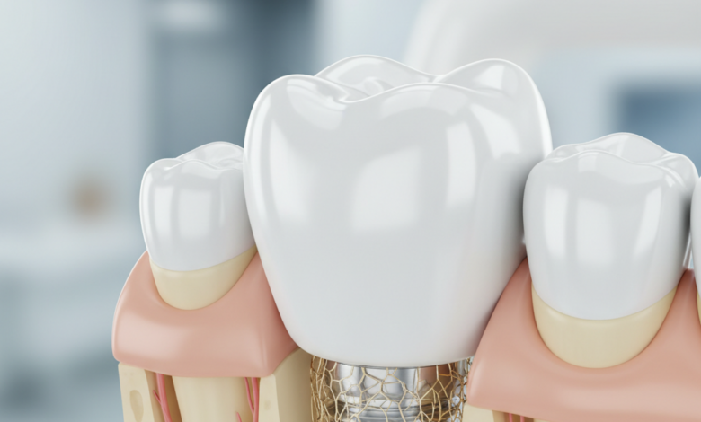 A photorealistic close-up of a perfectly integrated dental implant with a natural-looking white crown, set within healthy pink gum tissue. The background is a softly blurred, clean, and professional environment, highlighting the precision and strength of the dental restoration.