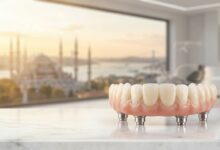 A photorealistic image of a complete zirconia dental prosthesis for an All-on-4 implant, displayed in a modern Turkish dental clinic with a blurred view of the Istanbul skyline.