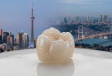 A perfect, high-quality white dental crown is in sharp focus in the foreground, with the blurred skylines of Canada and Turkey visible behind it, symbolizing the concept of international dental travel.