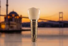 A photorealistic macro photograph of a single, high-quality dental implant and crown. The background is a soft, out-of-focus view of the Istanbul, Turkey skyline over the Bosphorus during a warm sunset.