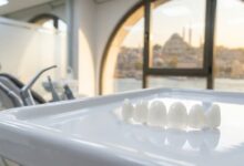 A close-up photorealistic image of several perfectly white porcelain veneers arranged on a clean surface in a modern, high-end dental clinic with a blurred cityscape in the background.