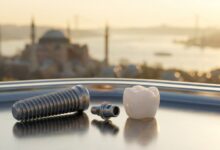 A close-up, photorealistic image showing a titanium dental implant post, an abutment, and a ceramic crown laid out on a clean surface. In the background, the Istanbul, Turkey skyline is softly blurred, creating a beautiful bokeh effect at sunrise.
