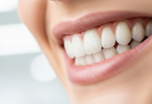 A photorealistic close-up of a beautiful, radiant smile with perfectly aligned, bright white teeth. The background is softly blurred, showing an impression of a clean, modern dental environment.