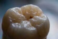 A photorealistic macro photograph of a human molar tooth. The tooth's surface is shown in extreme detail under cinematic lighting, revealing a tiny, dark spot on the enamel which represents the beginning of a cavity, all set against a softly blurred, clean background.