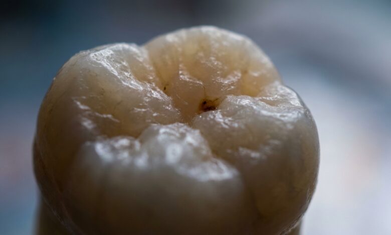 A photorealistic macro photograph of a human molar tooth. The tooth's surface is shown in extreme detail under cinematic lighting, revealing a tiny, dark spot on the enamel which represents the beginning of a cavity, all set against a softly blurred, clean background.