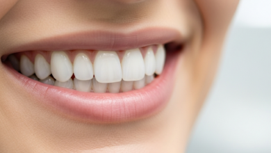 Close-up of a person's mouth with a radiant, perfectly white, and aligned smile, indicative of successfully applied dental veneers. The background is a softly blurred, clean, and bright clinical setting.