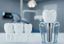 Photorealistic conceptual image comparing dental bridges and dental implants. On one side, three connected teeth form a bridge; on the other, a titanium implant post is embedded in bone with a crown. The background is a blurred modern dental clinic, with no text present.