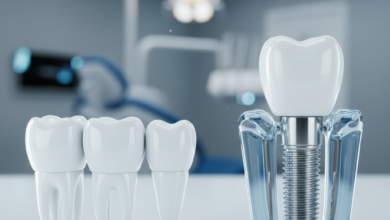 Photorealistic conceptual image comparing dental bridges and dental implants. On one side, three connected teeth form a bridge; on the other, a titanium implant post is embedded in bone with a crown. The background is a blurred modern dental clinic, with no text present.