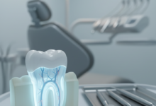 A close-up, highly detailed, and photorealistic image of a translucent anatomical model of a wisdom tooth within a conceptual jaw. The background shows a blurred modern dental clinic with sterile equipment, under soft, clinical lighting. The image evokes professionalism and clarity related to dental procedures.