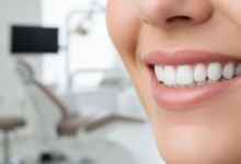 Close-up of a person with a bright, healthy, and confident smile, suggesting successful dental implant treatment. The background is a blurred, clean, and modern dental office interior.