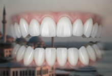 A close-up, photorealistic image of perfectly white, uniform teeth in sharp focus, with a blurred silhouette of a Turkish cityscape in the background, symbolizing dental tourism and cosmetic smile makeovers.