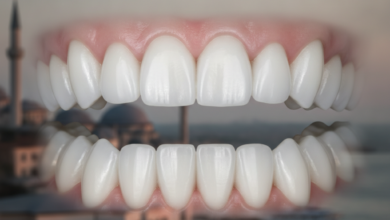 A close-up, photorealistic image of perfectly white, uniform teeth in sharp focus, with a blurred silhouette of a Turkish cityscape in the background, symbolizing dental tourism and cosmetic smile makeovers.