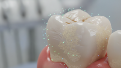 A detailed, close-up photograph of a human molar tooth with visible yellowish plaque along the gumline and slightly inflamed, reddish gum tissue. The background is blurred, suggesting a clean dental environment. The image depicts the early stages of neglected oral hygiene.