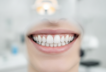 Close-up of a person's radiant, perfectly aligned, and brilliant white teeth, showcasing a flawless smile. The background is a softly blurred, modern, and clean dental clinic.