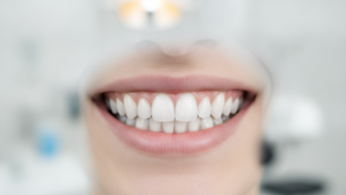 Close-up of a person's radiant, perfectly aligned, and brilliant white teeth, showcasing a flawless smile. The background is a softly blurred, modern, and clean dental clinic.