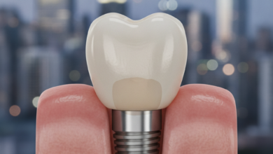A photorealistic close-up of a natural-looking dental crown on an implant, seamlessly integrated into gum tissue, with a softly blurred modern Canadian city skyline in the background.