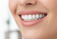A close-up, photorealistic image of a person's mouth with perfectly white, aligned, and symmetrical teeth, representing a 'Hollywood Smile,' set against a softly blurred, clean, modern background.