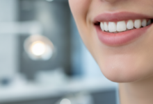 Close-up of a person's mouth showcasing a perfectly healthy, natural-looking smile with bright, aligned teeth. The background is a very blurred, softly lit, modern dental clinic interior.