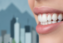 Close-up of a radiant, healthy smile with perfectly white teeth, subtly set against a softly blurred background suggesting a Canadian environment, conveying cleanliness and professionalism.